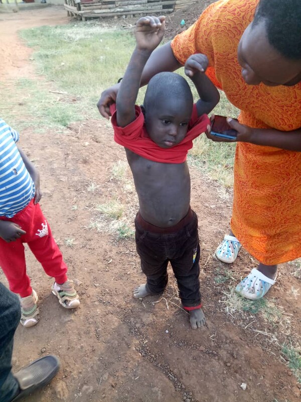 온 몸에 짓물과 상처로 범벅된 극심한 피부병을 앓고 있다가 극적으로 치유받은 무슬림 마을의 어린아이. /사랑하는교회