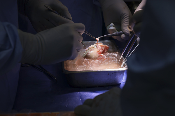 하버드 의대 매사추세츠 종합병원(MGH) 카와이 타츠오 박사, 나헬 엘리아스 박사팀이 유전자 편집·변형 돼지 신장을 성공적으로 이식했다. 사진은 수술팀의 외과의사들이 이식수술 전 돼지 신장을 준비하고 있는 모습. /MGH