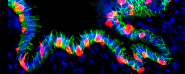 인슐린을 분비하도록 유전자를 조작한 인간의 위(胃) 오가노이드(hGO-NPM). /Hyungkee Kim